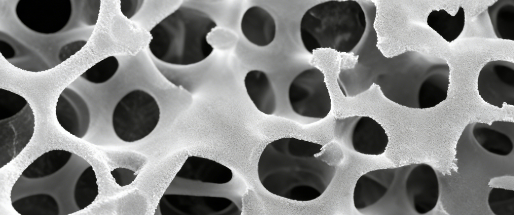 领跑丝素骨修复 易天然铸就三类器械创新标杆